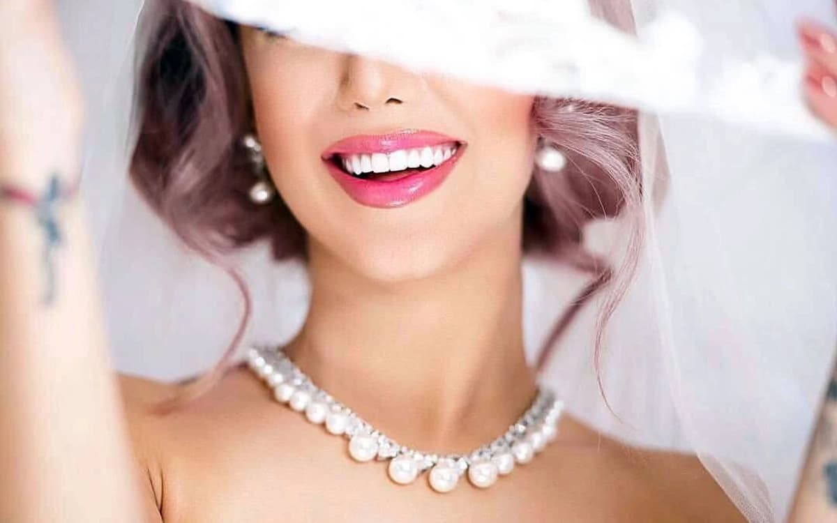 Gülüş Tasarımı (Hollywood Smile) Nedir? Aşamaları, Kullanılan Malzemeler ve Kalıcılığı
