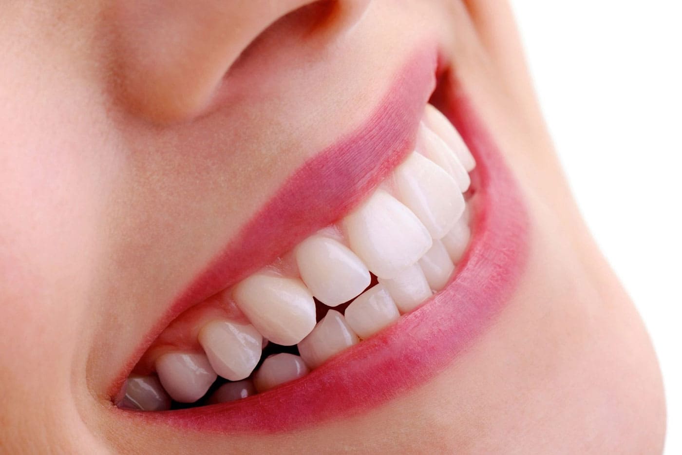 Lazerle Diş Beyazlatma (Bleaching)