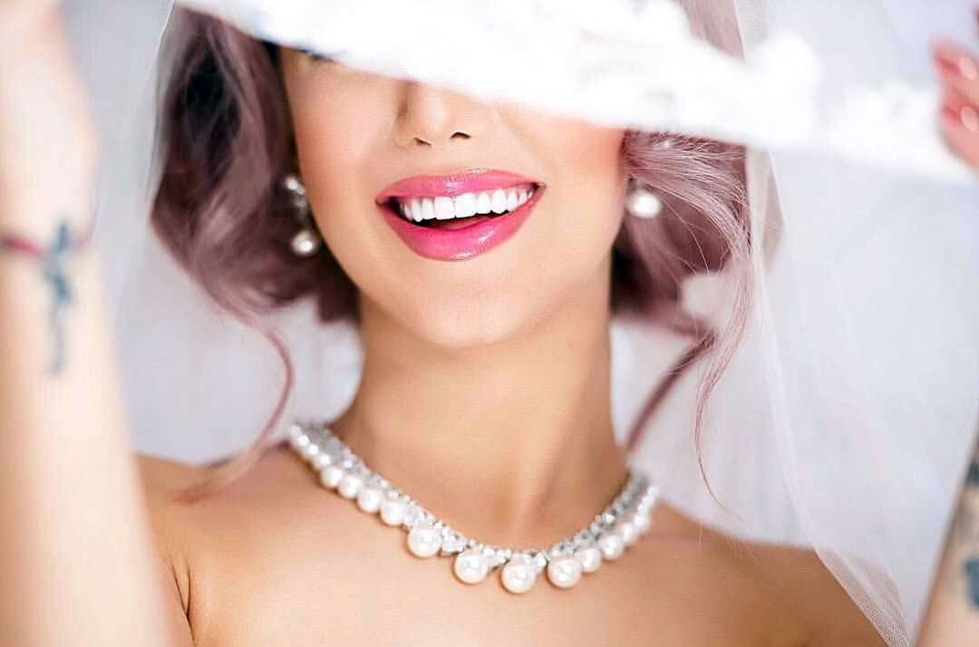 Gülüş Tasarımı (Hollywood Smile)