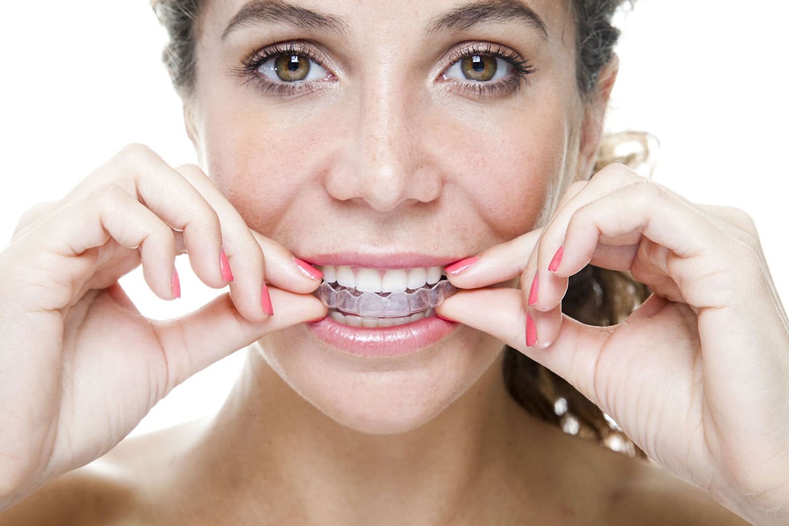 Şeffaf Plak (Invisalign) Tedavisi